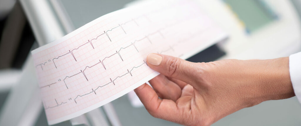 Kardiologia - elektrokardiogram
